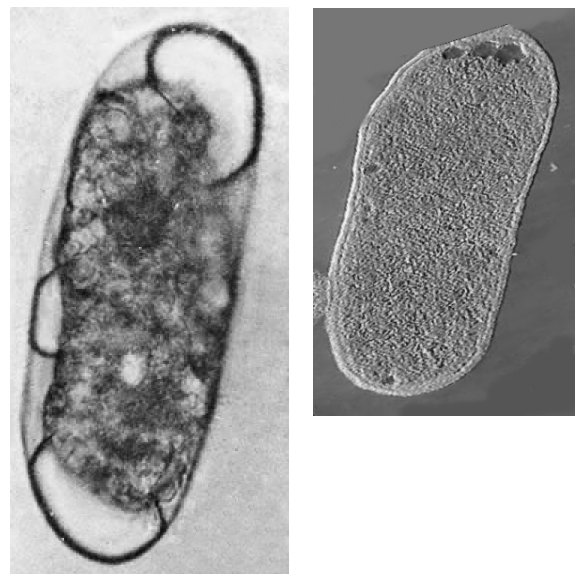 salmonella-typhi23000