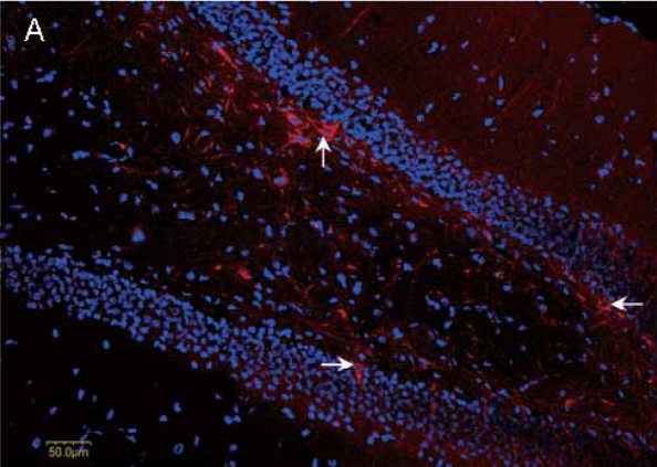 micelles-neurons