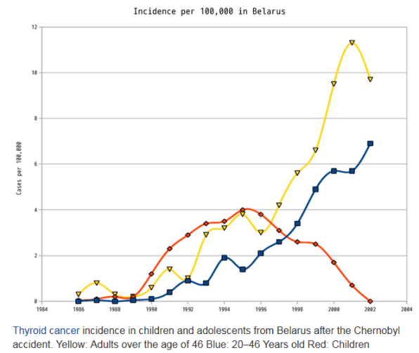 Chernobyl-thyroid-cancer-belarus