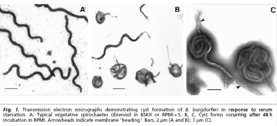 Borrelia-cysts