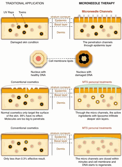 0 face alcohol wash Dermarolling explained