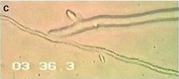 pythium-oligandrum3