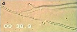 pythium-oligandrum4