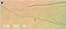 pythium-oligandrum5