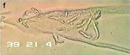 pythium-oligandrum6